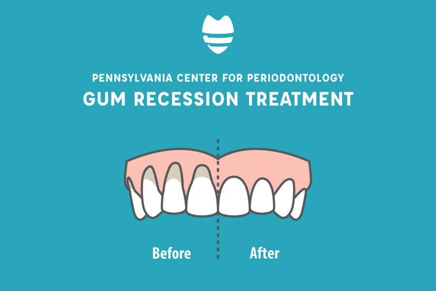 Can receding gums be repaired?